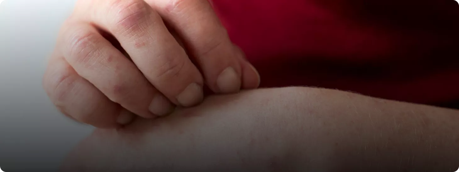 How Toxins Are Absorbed Through the Skin - The Hidden Risk